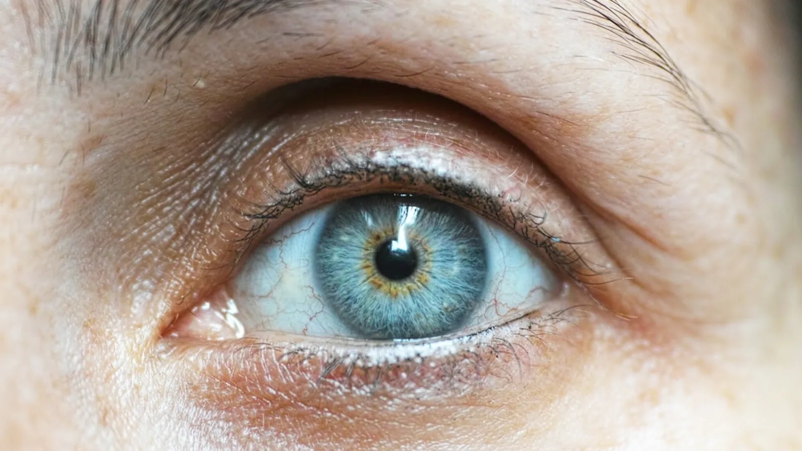 Why Do We Get Goosebumps? The Evolutionary Reason Explained