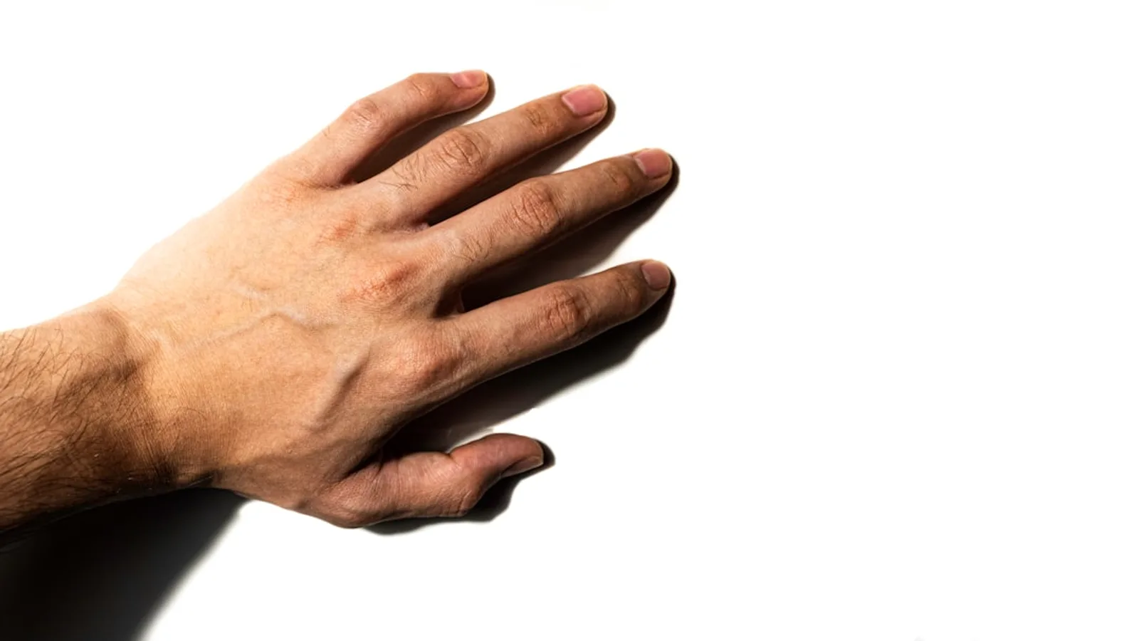 Why Do We Have Fingerprints?